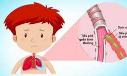 Vì sao trẻ ho nhiều, khò khè kéo dài?