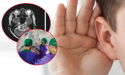 Đau đầu phát hiện khối u nằm ở vị trí nguy hiểm trong não 