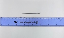 Lấy thành công kim khâu dài 6 cm nằm trong gan người đàn ông 