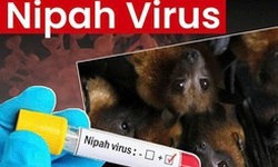 Bộ Y tế hướng dẫn chẩn đoán và điều trị bệnh truyền nhiễm do virus Nipah