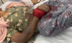 Tự chữa sau khi bị rắn độc cắn, một phụ nữ ở Lâm Đồng nguy kịch