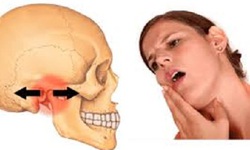 Trật khớp thái dương hàm có biểu hiện gì?