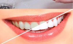 5 cách giúp trắng răng, giữ hơi thở thơm tho - bạn đã biết chưa?