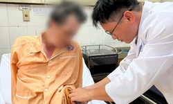 Thoát nguy cơ tàn phế sau tai nạn giao thông nhờ ca phẫu thuật đặc biệt