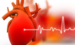 Nhận diện rối loạn nhịp tim nguy kịch cần cấp cứu ngay