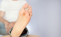 Vì sao người đái tháo đường bị mất cảm giác ở bàn chân và cách chăm sóc đúng