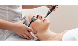 Ưu và nhược điểm khi trẻ hóa da bằng laser