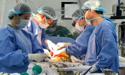 Phẫu thuật thành công ca u gan hiểm hóc từng bị từ chối điều trị