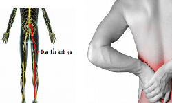 Vitamin và khoáng chất nào tốt cho người đau thần kinh tọa?