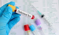 5 cập nhật mới về quản lý cholesterol không cần dùng thuốc