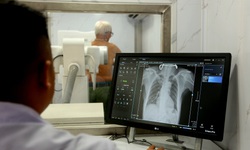 Phát hiện sớm để chặn nguồn lây bệnh lao trong cộng đồng