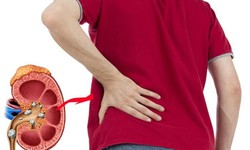 Suy thận không phải do tuổi tác: Thủ phạm nằm ngay trên mâm cơm của bạn