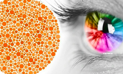 Bệnh mù màu có biểu hiện như thế nào?