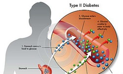 Loại thuốc trị đái tháo đường mới vừa kiểm soát đường huyết, vừa hỗ trợ giảm cân