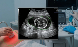 Nước ối ít và biến chứng thai kỳ: 'Cảnh báo đỏ' mẹ bầu cần lưu tâm