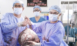 Bụng to bất thường, cô gái 25 tuổi phát hiện u xơ tử cung gần 12kg