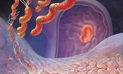 Viêm loét dạ dày – tá tràng: Dùng thuốc đúng cách để bảo vệ niêm mạc