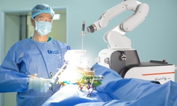 Việt Nam lần đầu có Robot AI thay khớp thế hệ mới, tăng cao hiệu quả và an toàn