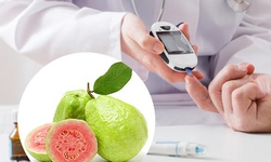 5 nhóm người không nên ăn ổi