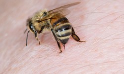 Những sai lầm nguy hiểm cần tránh khi bị ong đốt