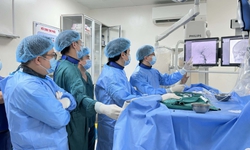 'Giải cứu' mắt lồi do rò động mạch cảnh xoang hang phức tạp bằng can thiệp nội mạch