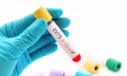 Trẻ mắc tay chân miệng do virus EV71 dễ chuyển nặng: khả năng tồn tại và lây lan của virus là bao lâu?