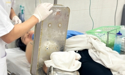 Người phụ nữ nhập viện với bàn tay vẫn còn kẹt nguyên trong máy xay thịt