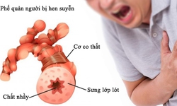 Nhận biết sớm cơn hen phế quản nguy kịch