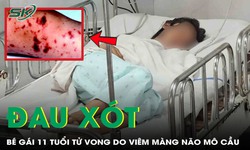Đau xót: Bé gái 11 tuổi tử vong do viêm màng não mô cầu thể tối cấp