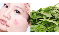 Cách dùng rau mồng tơi chữa lành da mụn trứng cá