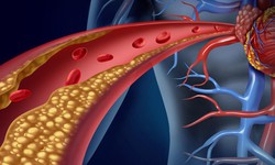 Cholesterol cao không chỉ do ăn dầu mỡ, nguyên nhân chính thường bị bỏ qua