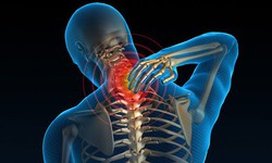 Đau vai gáy, thoát vị đĩa đệm – 'Cây Một Dược' và xu hướng hỗ trợ từ thiên nhiên