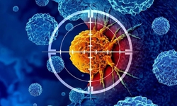 Trung Quốc phê duyệt thuốc chẩn đoán hình ảnh hạt nhân giúp phát hiện khối u