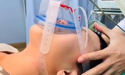 Bệnh Viện Nhi Hải Phòng cấy chỉ kết hợp gây mê hô hấp điều trị bệnh lý thần kinh và cơ xương khớp