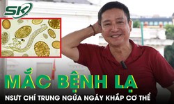 NSƯT Chí Trung mắc bệnh lạ, cơ thể đỏ như 'tôm luộc'