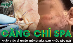 Căng chỉ nâng cơ ở spa, người phụ nữ nhập viện vì nhiễm trùng mặt