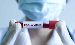 Tỉ lệ tử vong do Ebola có thể lên đến 90%, Bộ Y tế nêu các triệu chứng thường gặp khi mắc bệnh

