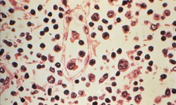 Đài Loan (Trung Quốc) ghi nhận 1 ca tử vong do nhiễm virus Hanta