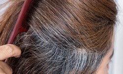 Những bệnh lý tiềm ẩn phía sau dấu hiệu tóc bạc sớm ở người trẻ