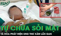 Tự chữa sỏi mật tại nhà, người đàn ông tá hỏa phát hiện ung thư xâm lấn gan