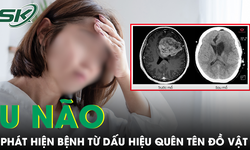 Liên tục quên tên đồ vật quen thuộc, người phụ nữ phát hiện khối u não nguy hiểm 