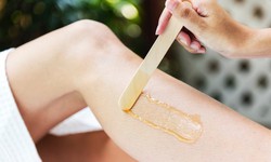 Rậm lông ở phụ nữ cảnh báo rối loạn nội tiết
