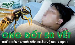 Bị ong vò vẽ đốt hơn 50 vết, thiếu niên 14 tuổi hoại tử, sốc phản vệ nguy kịch