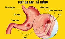 Những nguy cơ khi tự ý dùng meloxicam trị đau xương khớp