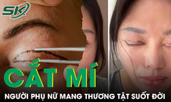 Tin lời 'chuyên gia' thẩm mỹ, người phụ nữ nhận kết cục đau đớn sau cắt mí mắt