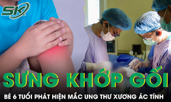 Sưng khớp gối kéo dài, bé trai 6 tuổi phát hiện mắc ung thư xương ác tính