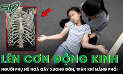 Người phụ nữ ngã gãy xương đòn, tràn máu màng phổi vì lên cơn động kinh