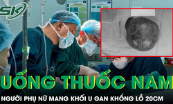 Người phụ nữ mang khối u gan khổng lồ 20cm sau thời gian tự chữa bằng thuốc nam