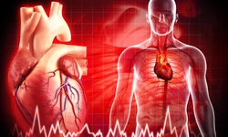 Mỡ máu cao – 'kẻ giết người thầm lặng' không gõ cửa báo trước