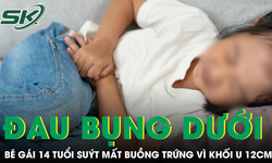 Tưởng đau bụng kinh, bé gái 14 tuổi suýt mất buồng trứng vì khối u 12cm